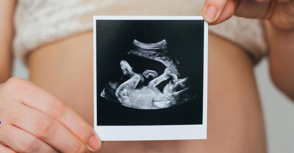 Ultrasound: is it really safe? image 