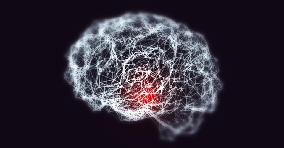 Candida causes memory loss—and perhaps Alzheimer's too image 