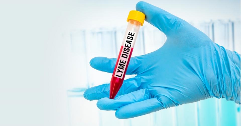 Lyme disease ticks attracted to people with Type A blood image 