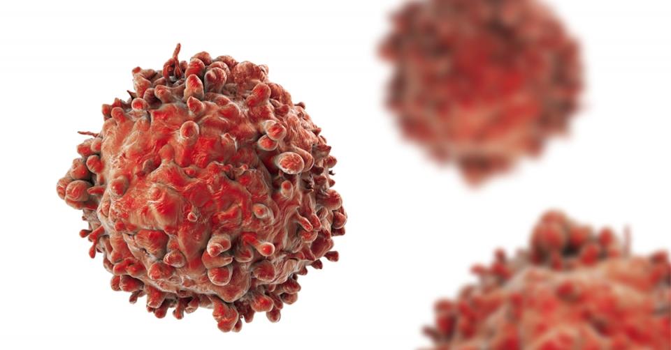 Chemical industry blocks report on cancer links image 